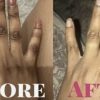 Knuckles, knees, feet’s etc maintenance cream